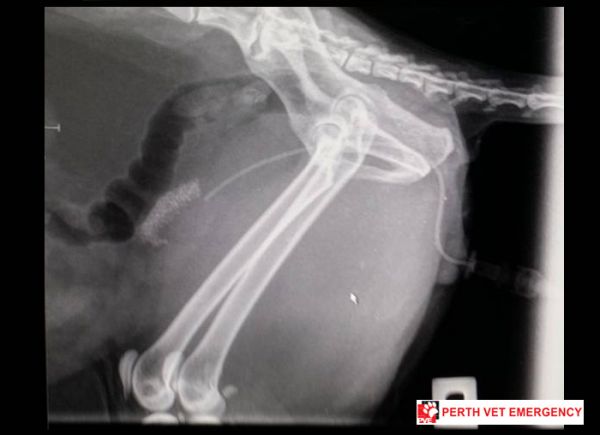 Radiograph of patient's catheter